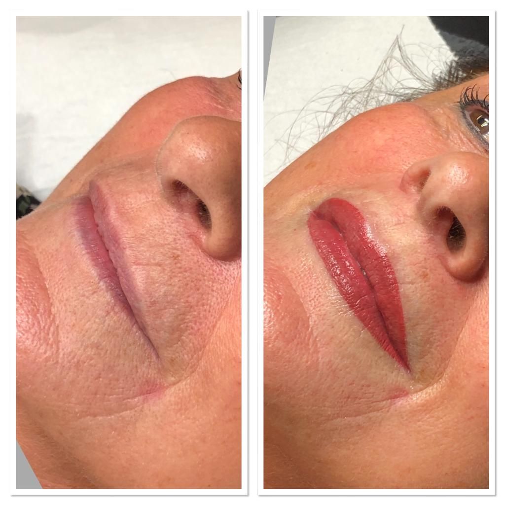 Permanente full lips voor en na de behandeling